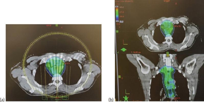 https://cdn.ncbi.nlm.nih.gov/pmc/blobs/1d87/12149233/243450312e93/can-19-1895fig5.jpg