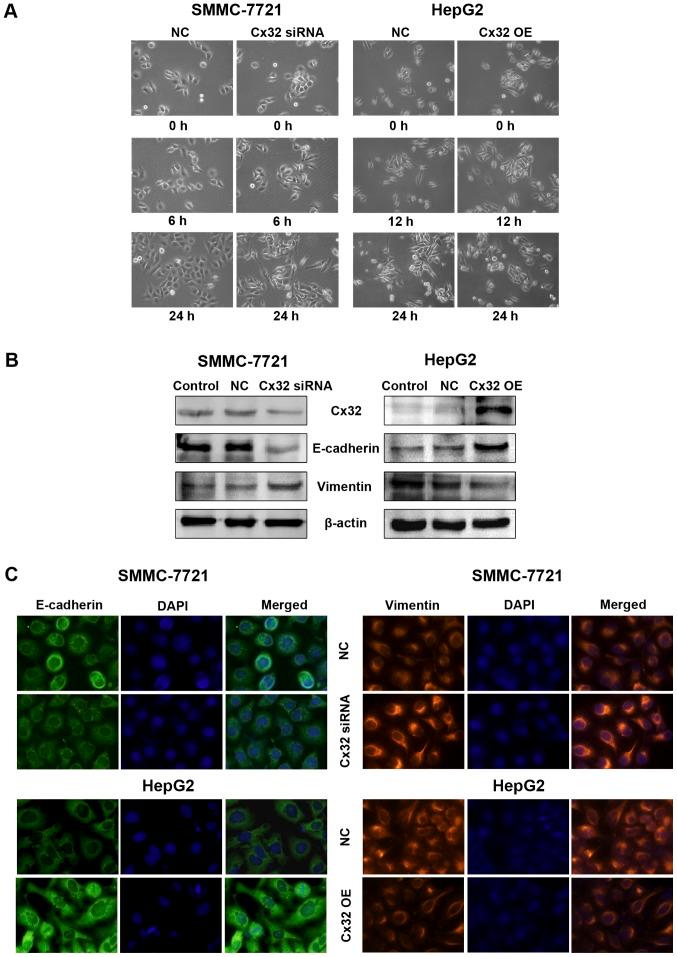https://cdn.ncbi.nlm.nih.gov/pmc/blobs/1d8e/5435329/cf3065f81ed4/IJO-50-06-1977-g02.jpg
