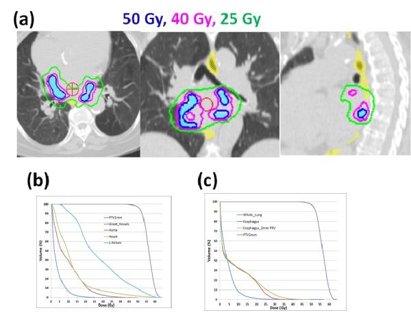 https://cdn.ncbi.nlm.nih.gov/pmc/blobs/1d91/4985047/fe48db5f2db9/cureus-0008-000000000678-i02.jpg