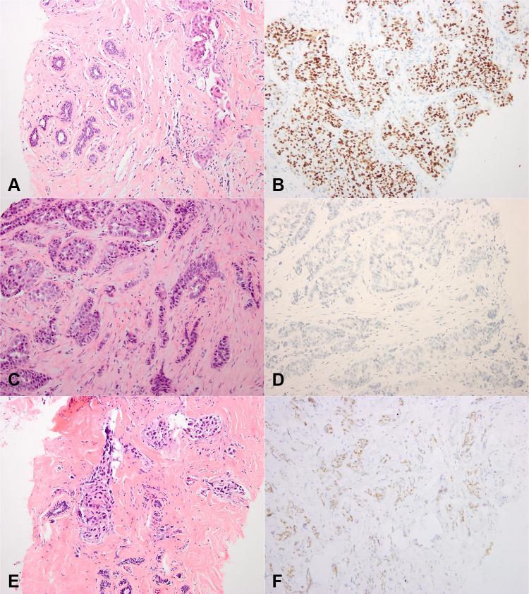 https://cdn.ncbi.nlm.nih.gov/pmc/blobs/1d94/7670084/c97fb8bd9a68/IJGM-13-1105-g0002.jpg