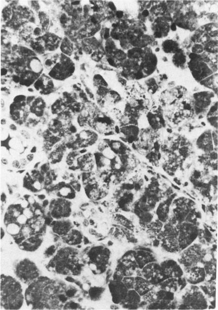 https://cdn.ncbi.nlm.nih.gov/pmc/blobs/1d95/1888342/0ed5cd027d58/amjpathol00156-0119-b.jpg
