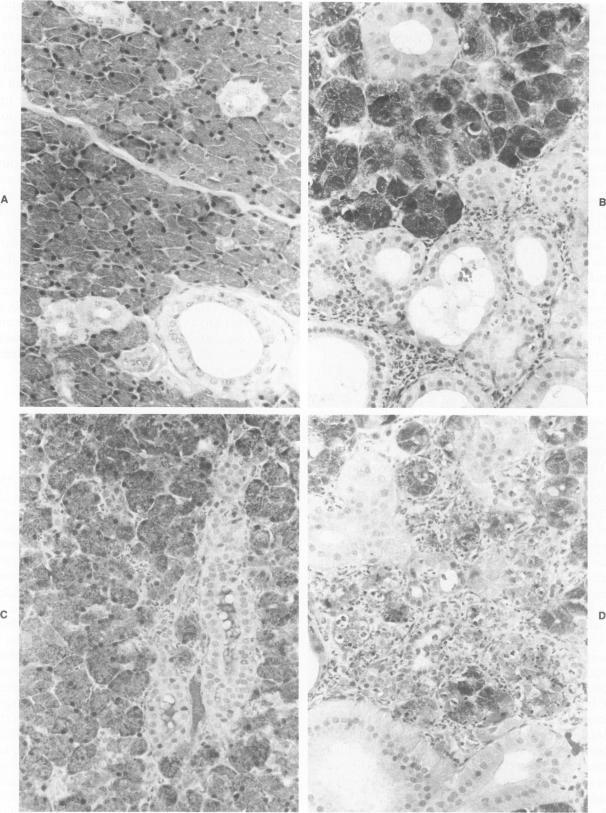 https://cdn.ncbi.nlm.nih.gov/pmc/blobs/1d95/1888342/ee2c9dab4a2e/amjpathol00156-0118-a.jpg