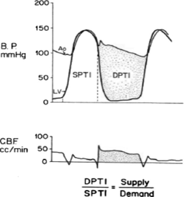 https://cdn.ncbi.nlm.nih.gov/pmc/blobs/1d98/3959699/4171367e9698/jah3-3-e000285-g1.jpg
