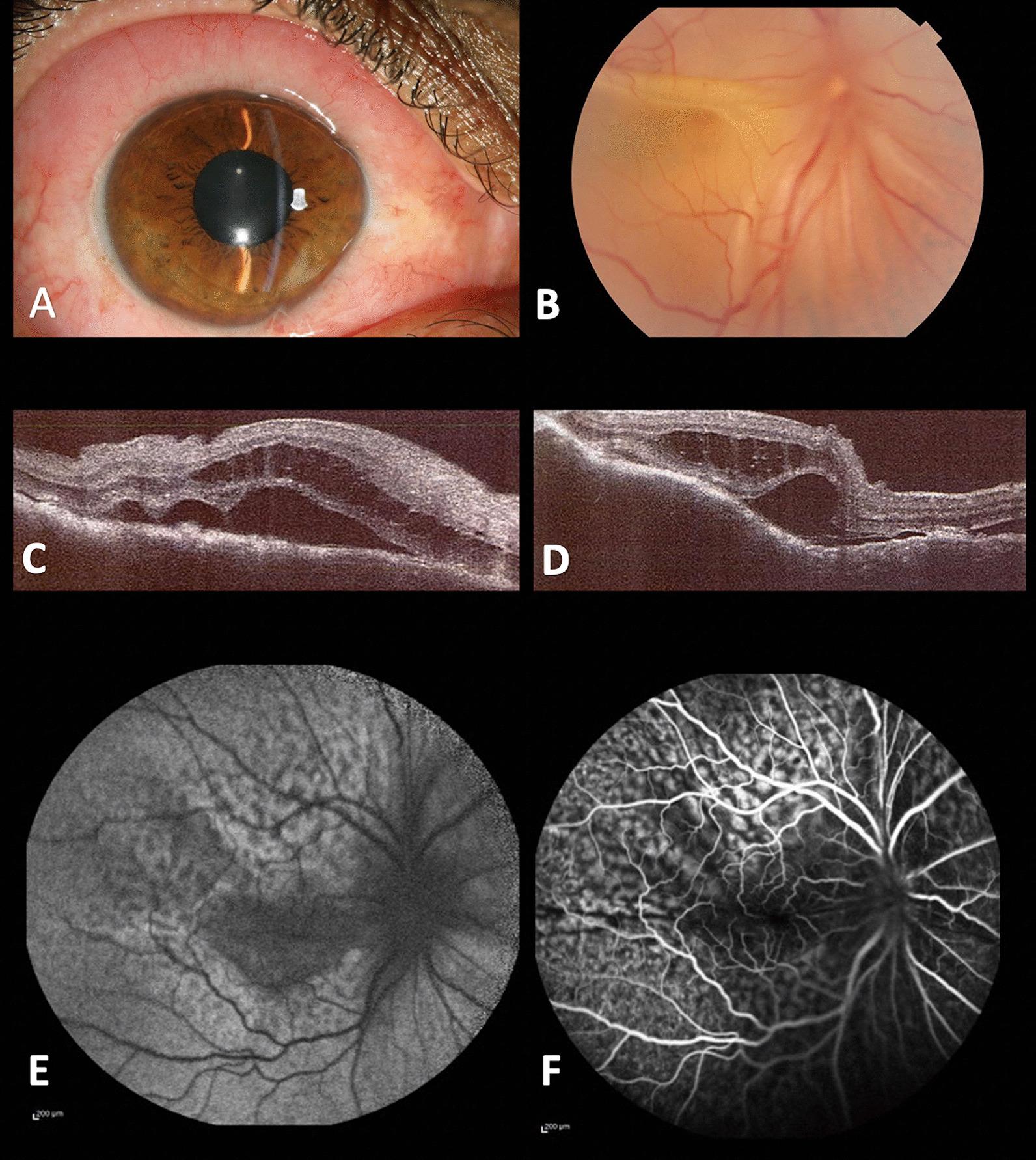 https://cdn.ncbi.nlm.nih.gov/pmc/blobs/1d98/9035257/8b4eef748c1f/13256_2022_3373_Fig1_HTML.jpg