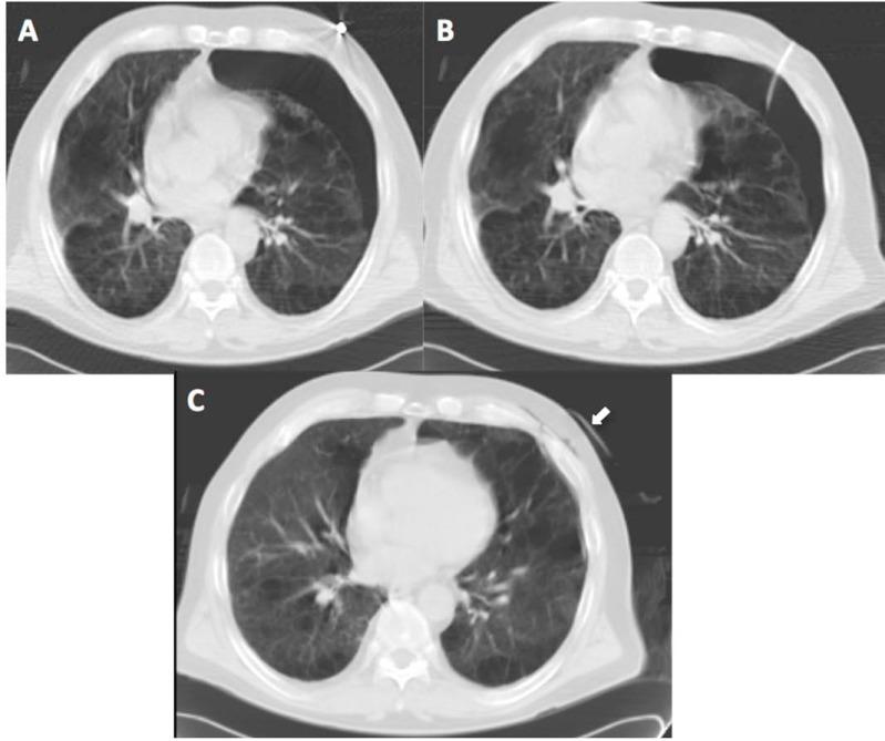 https://cdn.ncbi.nlm.nih.gov/pmc/blobs/1d99/3439799/22ff7141dc39/TORMJ-6-82_F3.jpg