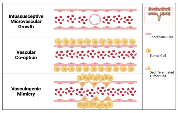 https://cdn.ncbi.nlm.nih.gov/pmc/blobs/1d9c/10296318/5d2c49e51a7e/cancers-15-03262-g002.jpg