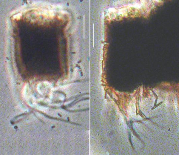 https://cdn.ncbi.nlm.nih.gov/pmc/blobs/1d9e/499547/56018363d8e8/1471-2202-5-23-1.jpg