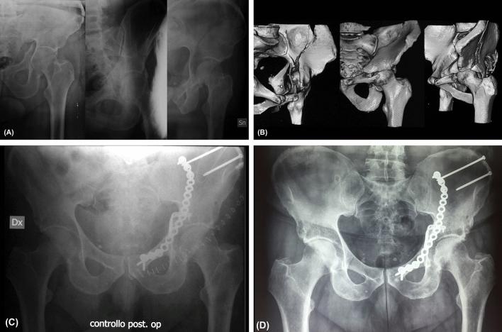 https://cdn.ncbi.nlm.nih.gov/pmc/blobs/1da1/8203512/3790b9c387d1/40520_2020_1682_Fig1_HTML.jpg