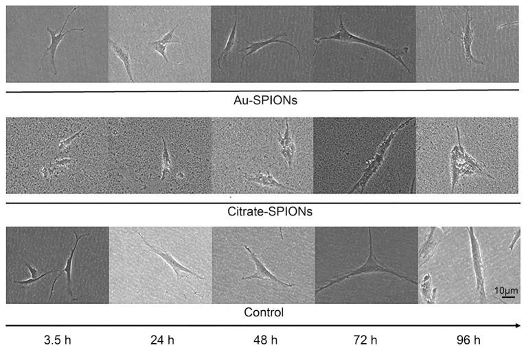https://cdn.ncbi.nlm.nih.gov/pmc/blobs/1dae/9774466/bf3d08bec88e/bioengineering-09-00806-g003.jpg