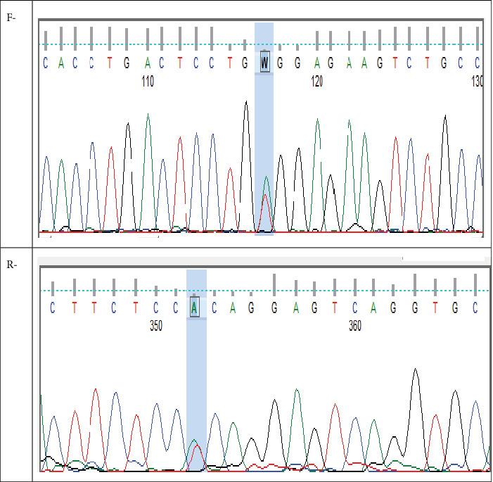 https://cdn.ncbi.nlm.nih.gov/pmc/blobs/1db9/12398415/b30736843c38/IJG2025-6664418.006.jpg