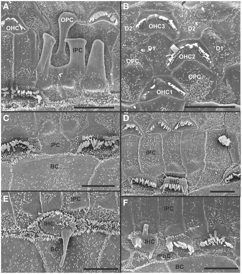 https://cdn.ncbi.nlm.nih.gov/pmc/blobs/1dc5/4364252/633861a848e7/fnagi-07-00033-g0009.jpg
