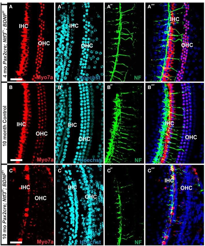 https://cdn.ncbi.nlm.nih.gov/pmc/blobs/1dc5/4364252/86341c7780c9/fnagi-07-00033-g0007.jpg
