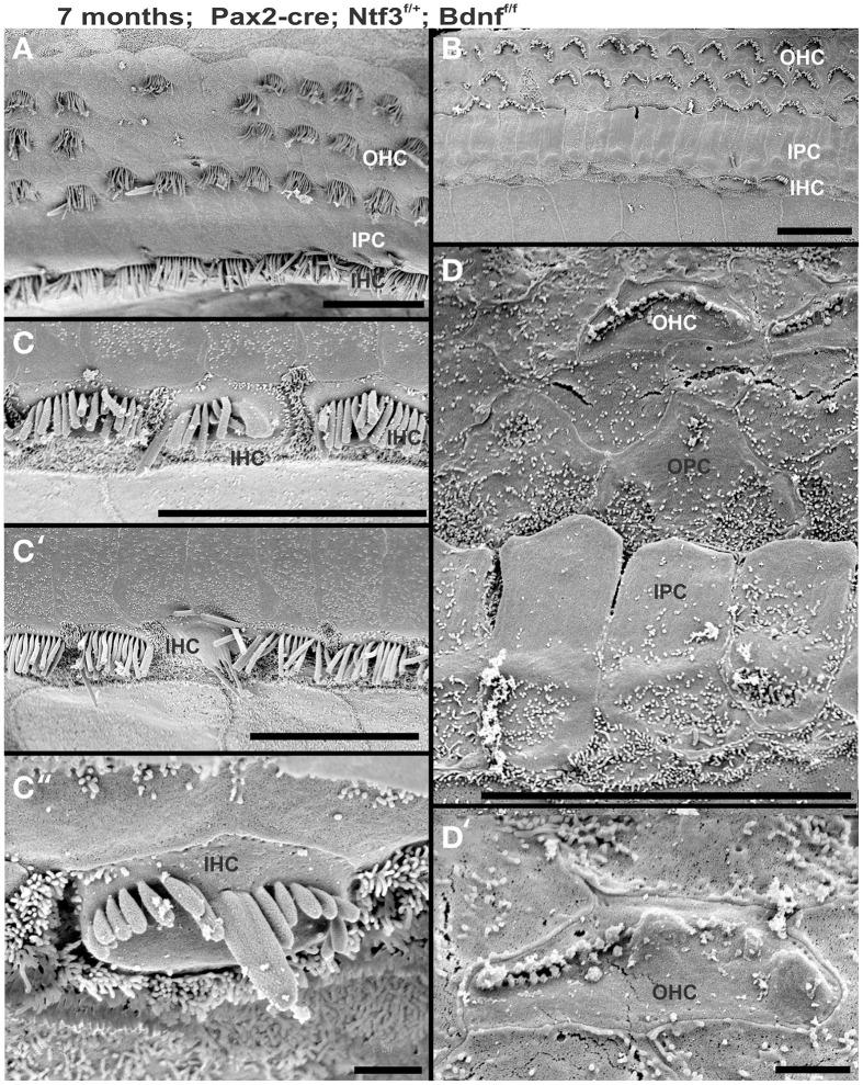 https://cdn.ncbi.nlm.nih.gov/pmc/blobs/1dc5/4364252/8df21cbf5520/fnagi-07-00033-g0010.jpg