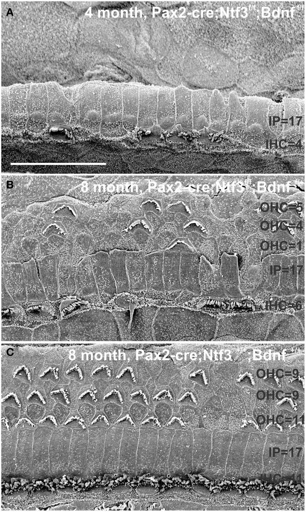 https://cdn.ncbi.nlm.nih.gov/pmc/blobs/1dc5/4364252/addaaa8e691c/fnagi-07-00033-g0013.jpg
