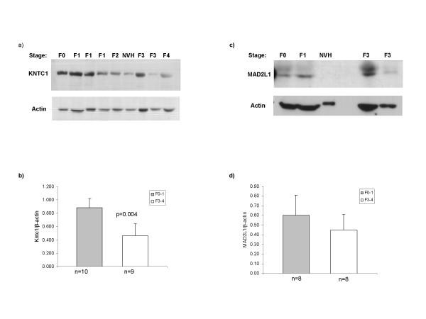 https://cdn.ncbi.nlm.nih.gov/pmc/blobs/1dc6/2739854/530ec27a2fe5/1471-2334-9-125-4.jpg