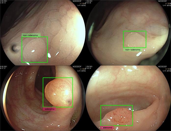 https://cdn.ncbi.nlm.nih.gov/pmc/blobs/1dc9/9247164/7ffde395d640/41746_2022_633_Fig4_HTML.jpg