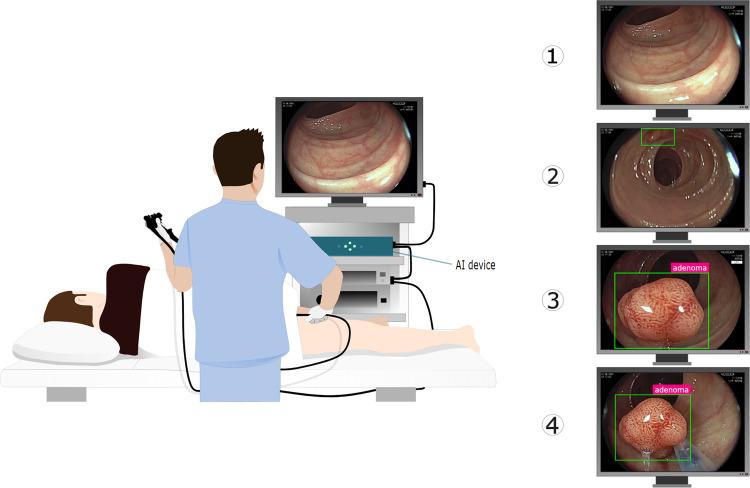 https://cdn.ncbi.nlm.nih.gov/pmc/blobs/1dc9/9247164/a7f7eae10918/41746_2022_633_Fig1_HTML.jpg