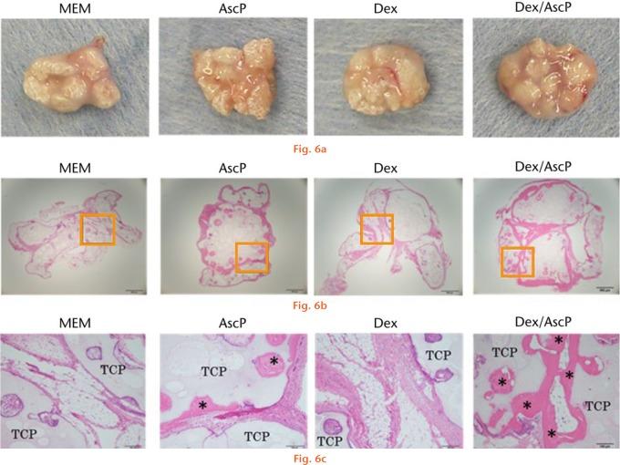 https://cdn.ncbi.nlm.nih.gov/pmc/blobs/1ddb/5131089/5b5601c192f5/bonejointres-05-569-g006.jpg