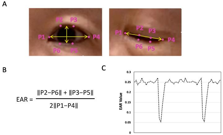 https://cdn.ncbi.nlm.nih.gov/pmc/blobs/1dde/10607458/0af239ec7881/jcm-12-06479-g002.jpg