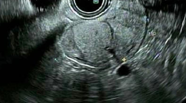 https://cdn.ncbi.nlm.nih.gov/pmc/blobs/1de3/7570429/dbfebbb9f2f0/gr3.jpg