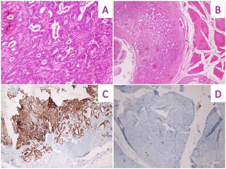 https://cdn.ncbi.nlm.nih.gov/pmc/blobs/1de4/10702251/3f2a1851eceb/cureus-0015-00000048437-i07.jpg