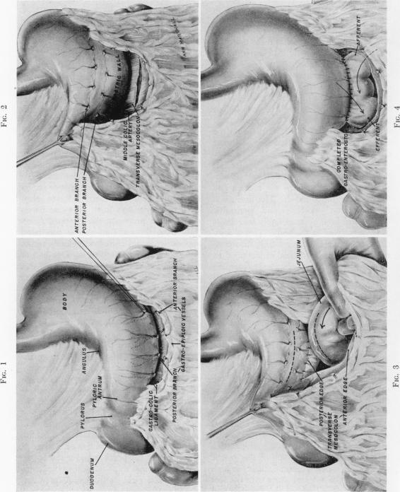 https://cdn.ncbi.nlm.nih.gov/pmc/blobs/1de6/1802641/29597f8cd630/annsurg01434-0066-a.jpg