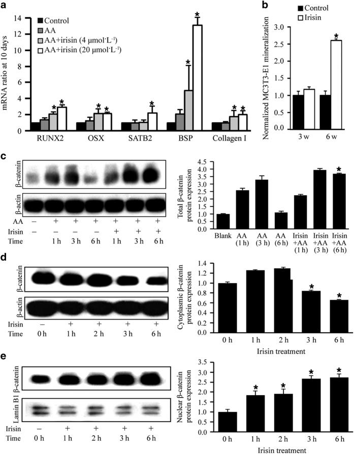 https://cdn.ncbi.nlm.nih.gov/pmc/blobs/1de6/5605767/2e84cd3fcd04/boneres201656-f4.jpg