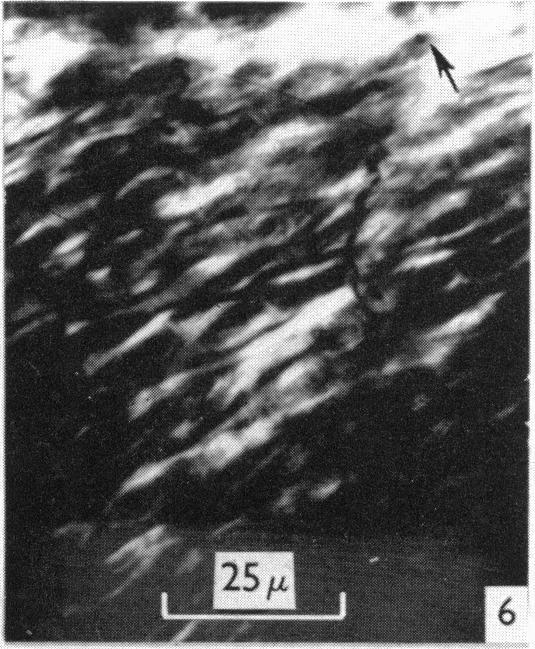 https://cdn.ncbi.nlm.nih.gov/pmc/blobs/1dea/1244064/514da7d337b2/janat00437-0076-b.jpg