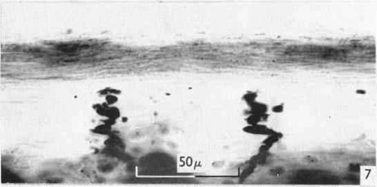 https://cdn.ncbi.nlm.nih.gov/pmc/blobs/1dea/1244064/803754bf6e95/janat00437-0076-c.jpg
