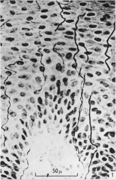 https://cdn.ncbi.nlm.nih.gov/pmc/blobs/1dea/1244064/855077835325/janat00437-0075-a.jpg