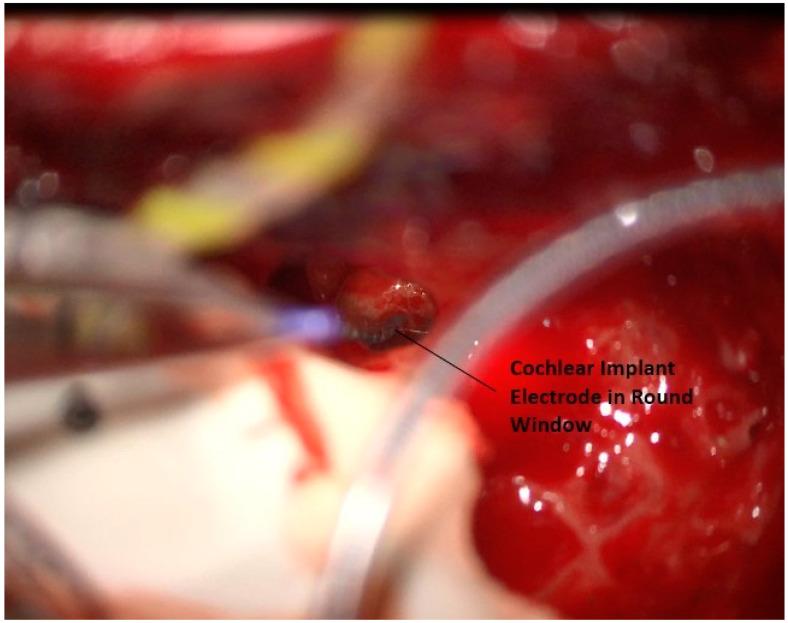 https://cdn.ncbi.nlm.nih.gov/pmc/blobs/1dee/10532076/e0bb26f636e3/jcm-12-05875-g014.jpg