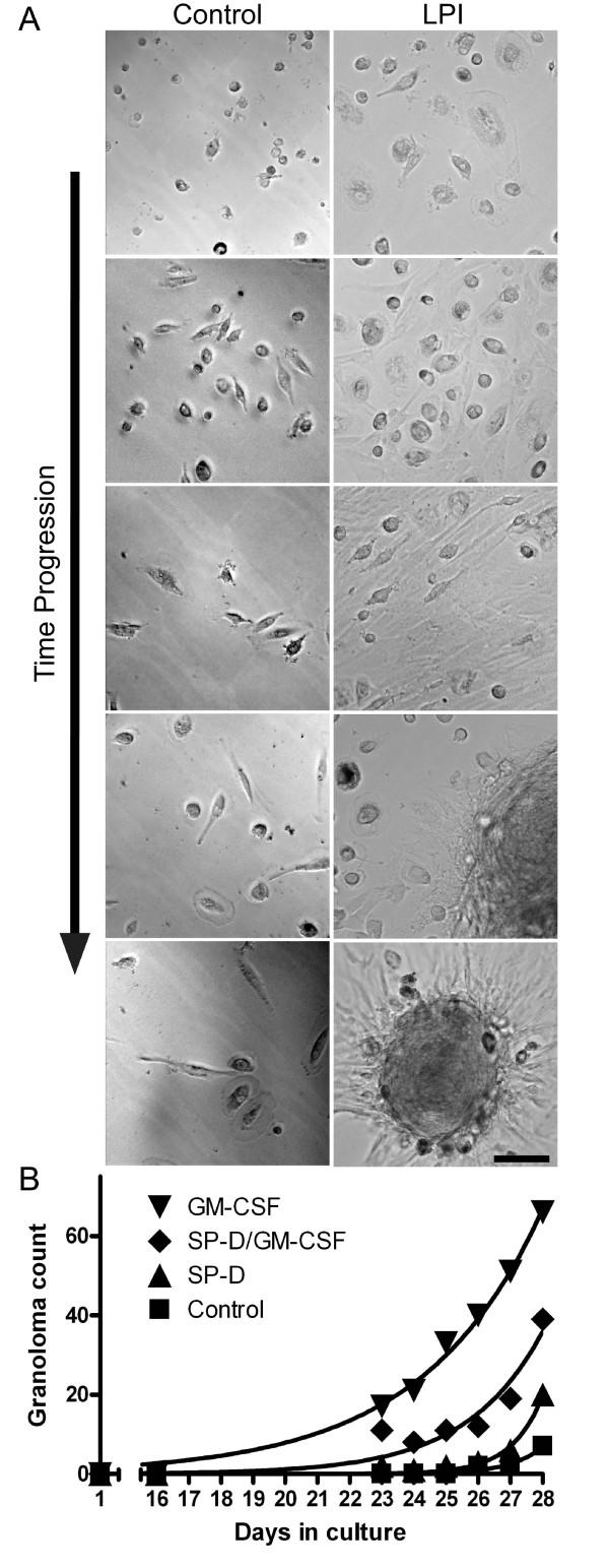 https://cdn.ncbi.nlm.nih.gov/pmc/blobs/1df6/2807424/0907e390c1f7/1750-1172-4-29-5.jpg