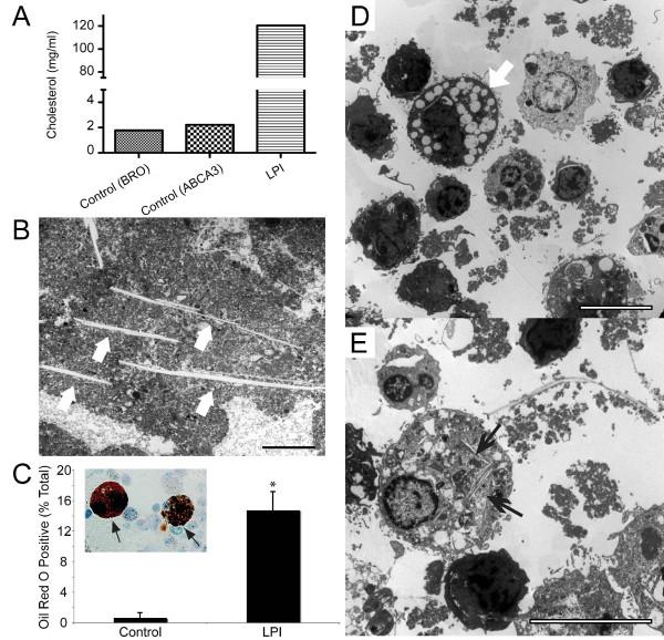 https://cdn.ncbi.nlm.nih.gov/pmc/blobs/1df6/2807424/769c57153e62/1750-1172-4-29-2.jpg