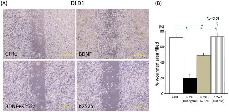 https://cdn.ncbi.nlm.nih.gov/pmc/blobs/1df9/4011754/10fa84ed6397/pone.0096410.g005.jpg