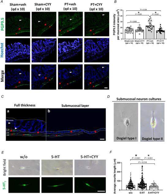 https://cdn.ncbi.nlm.nih.gov/pmc/blobs/1dfb/12400787/d06b10ff1cd3/TJP-603-4723-g004.jpg