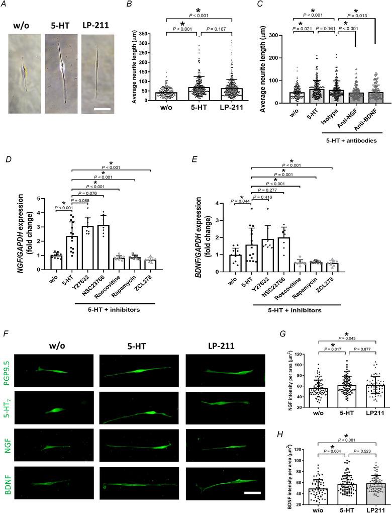https://cdn.ncbi.nlm.nih.gov/pmc/blobs/1dfb/12400787/dfae93ece4e9/TJP-603-4723-g007.jpg