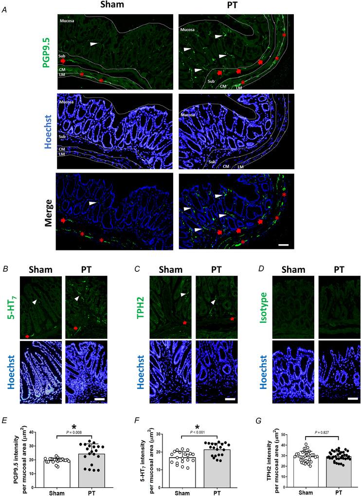 https://cdn.ncbi.nlm.nih.gov/pmc/blobs/1dfb/12400787/e6d37d3e0ea4/TJP-603-4723-g006.jpg