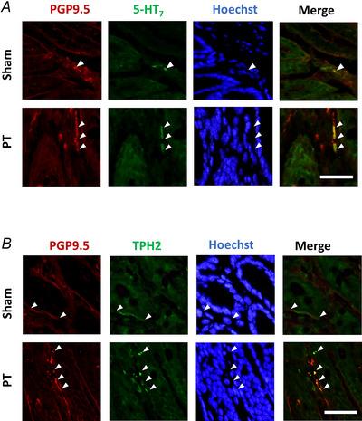 https://cdn.ncbi.nlm.nih.gov/pmc/blobs/1dfb/12400787/e8044eb1cd7d/TJP-603-4723-g005.jpg