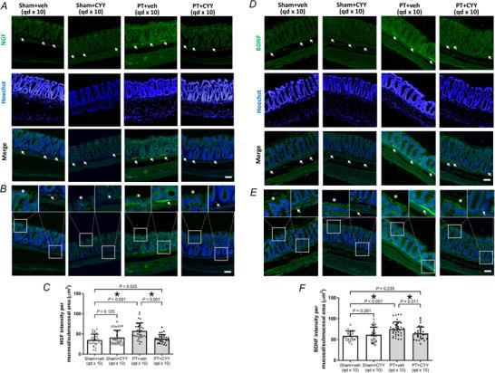 https://cdn.ncbi.nlm.nih.gov/pmc/blobs/1dfb/12400787/eaf3dbd49af1/TJP-603-4723-g003.jpg