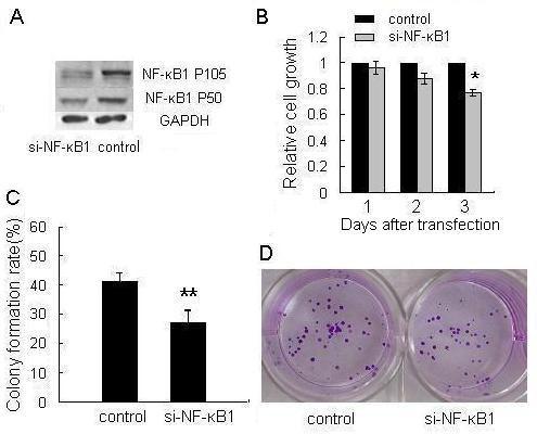 https://cdn.ncbi.nlm.nih.gov/pmc/blobs/1dfd/2835654/c638d5e9169d/1476-4598-9-16-6.jpg