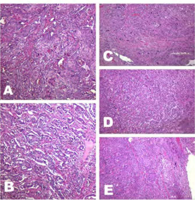 https://cdn.ncbi.nlm.nih.gov/pmc/blobs/1e00/10628873/2d80c76010b7/MJR-34-3-363-g004.jpg