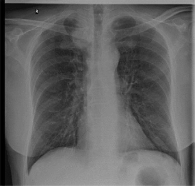https://cdn.ncbi.nlm.nih.gov/pmc/blobs/1e00/10628873/d17ec7030e21/MJR-34-3-363-g001.jpg