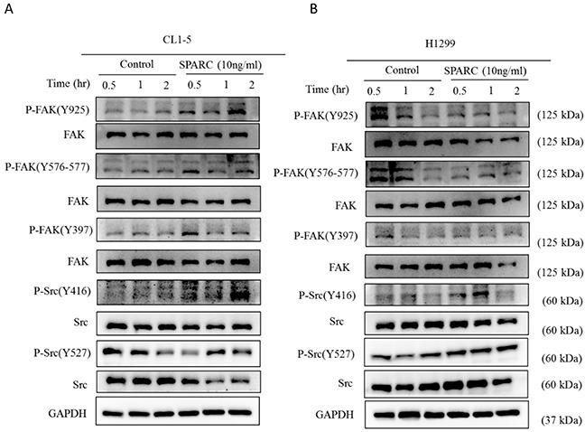 https://cdn.ncbi.nlm.nih.gov/pmc/blobs/1e00/5609953/9f47f883b1bb/oncotarget-08-63691-g002.jpg