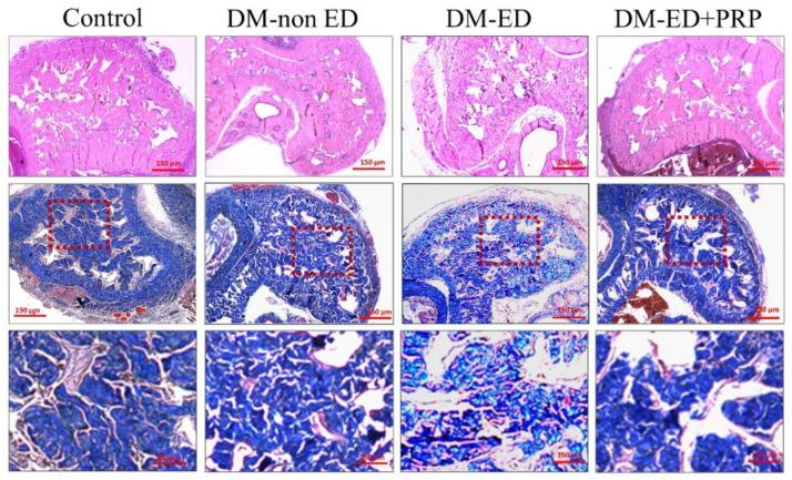 https://cdn.ncbi.nlm.nih.gov/pmc/blobs/1e06/8948834/c8f67eff44d8/ijms-23-03017-g006.jpg