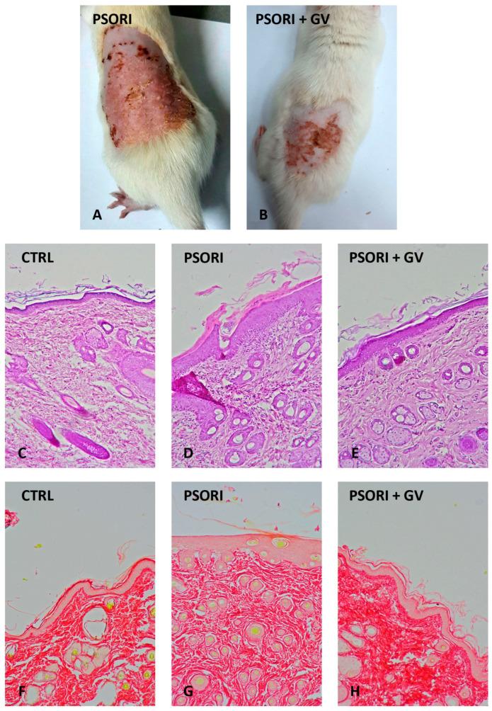 https://cdn.ncbi.nlm.nih.gov/pmc/blobs/1e0d/12347447/8903fd54a803/ijms-26-07290-g005.jpg