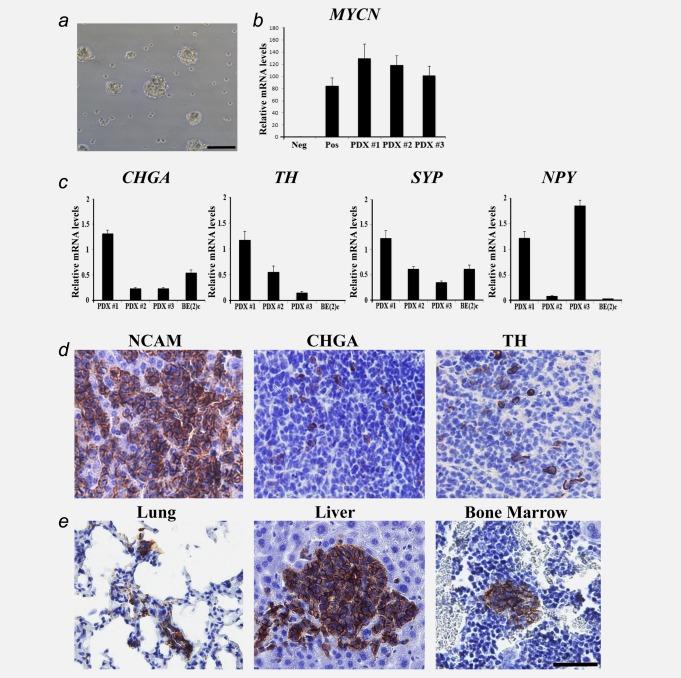 https://cdn.ncbi.nlm.nih.gov/pmc/blobs/1e0d/4299502/0e440794903c/ijc0136-E252-f5.jpg