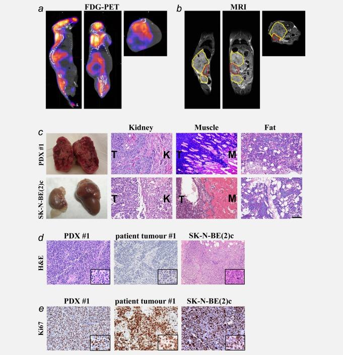 https://cdn.ncbi.nlm.nih.gov/pmc/blobs/1e0d/4299502/a84cc252a44a/ijc0136-E252-f1.jpg