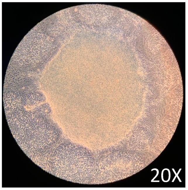 https://cdn.ncbi.nlm.nih.gov/pmc/blobs/1e0f/11395045/631d112c348d/ijms-25-09654-g001.jpg