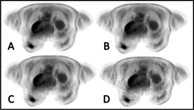 https://cdn.ncbi.nlm.nih.gov/pmc/blobs/1e11/10415438/5e18126f77e0/330_2023_9580_Fig2_HTML.jpg