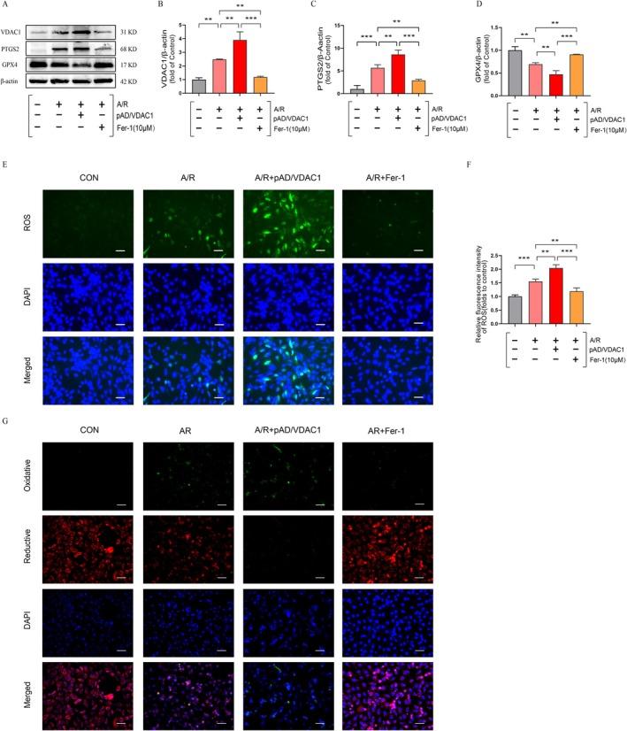 https://cdn.ncbi.nlm.nih.gov/pmc/blobs/1e12/12185369/057329f35786/JCMM-29-e70650-g003.jpg